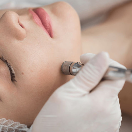 La microdermabrasion : tout ce que vous devez savoir sur ce soin révélateur d’éclat