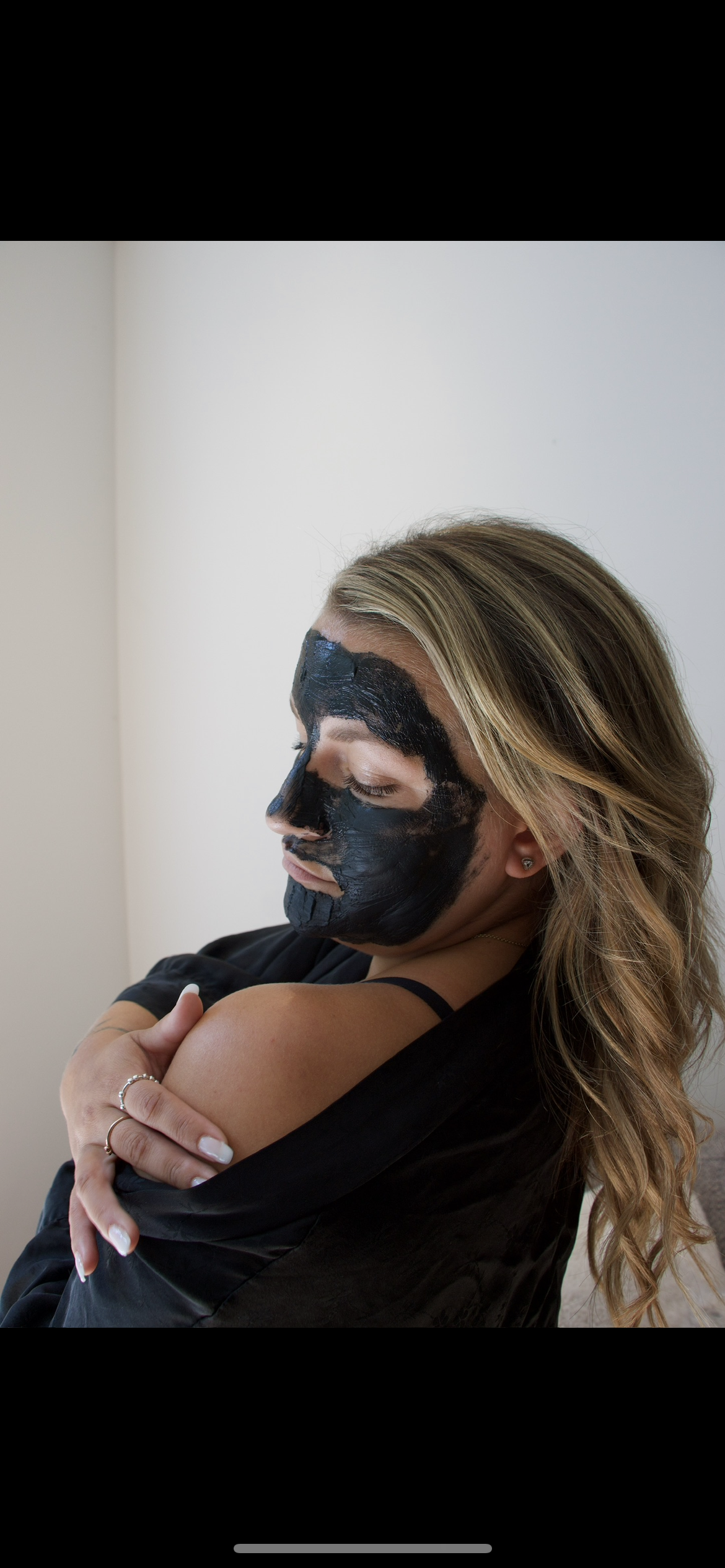 Microdermabrasion